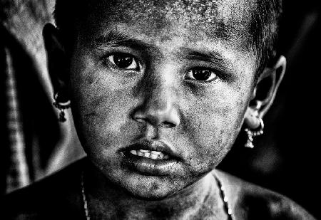 Rohingya refugee girl - Bangladesh